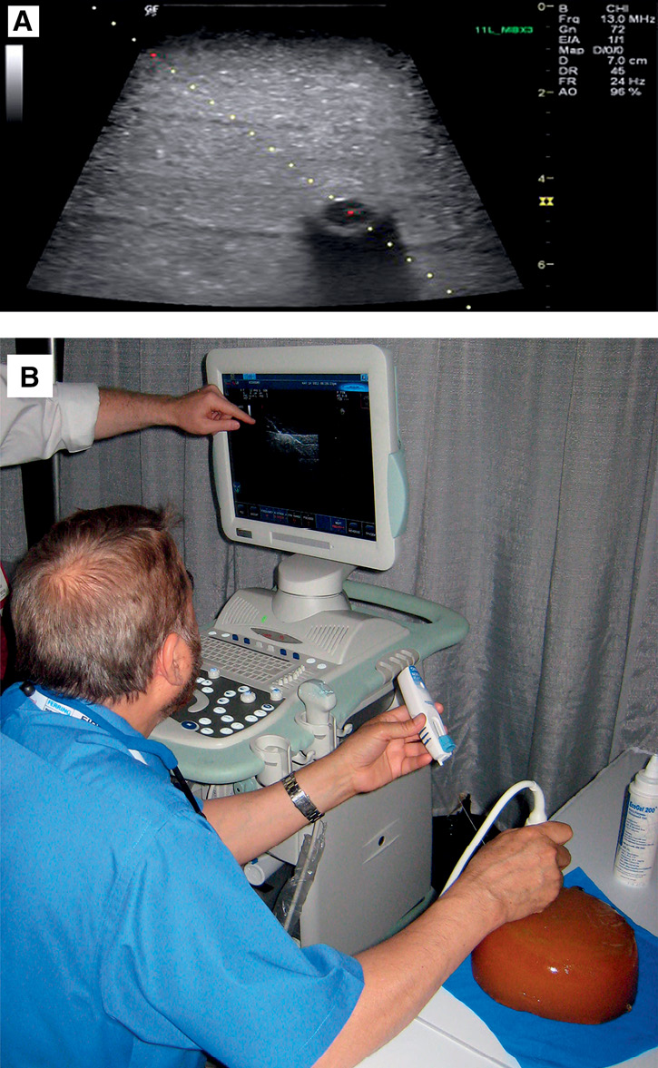 AUA2023: REFLECTIONS Hands-on Urological Ultrasound Course 2023 ...